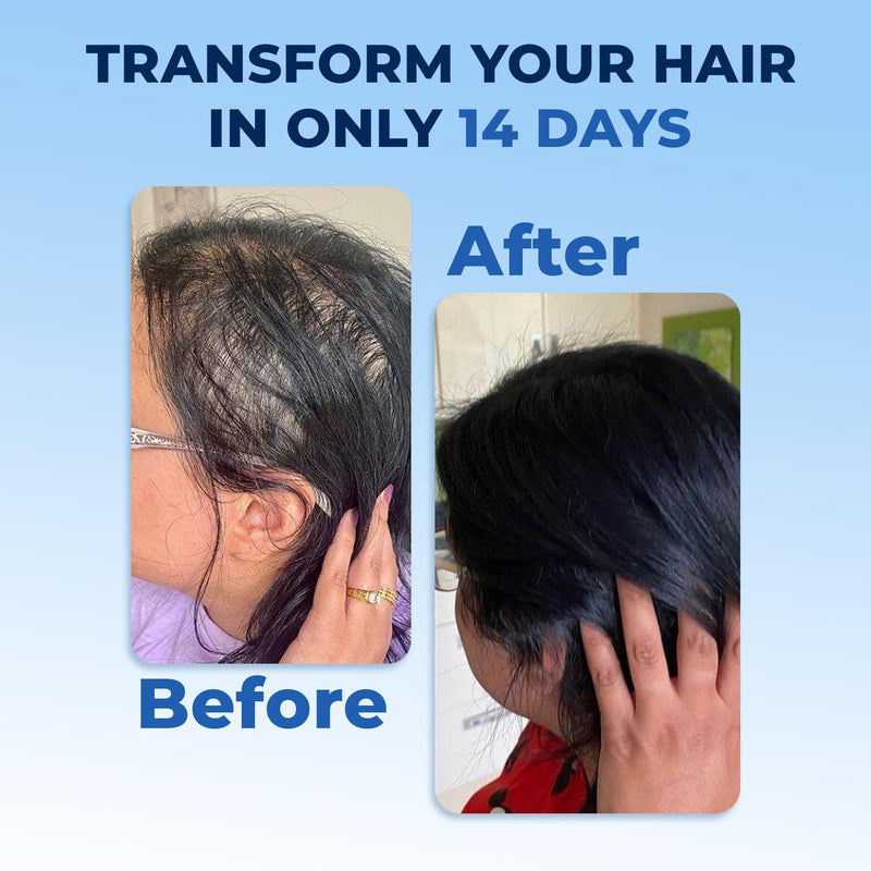FEG Hair Revival Spray – Stop Hair Fall, Restore Confidence
