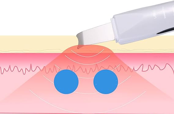 Reveal Your Natural Glow — Deep Pore Blackhead